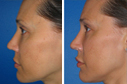 Before & After Photos